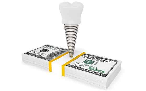 Dental implant on some money