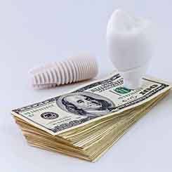 Dental implant on a pile of money